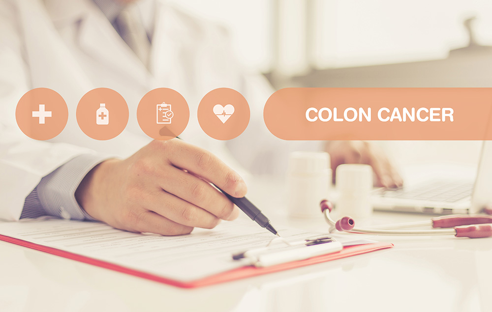 ​  Improving drug options for colorectal cancer patients