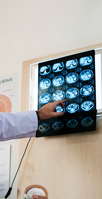 ​  New midlife MRI spots rapid aging, signs of disease long before symptoms