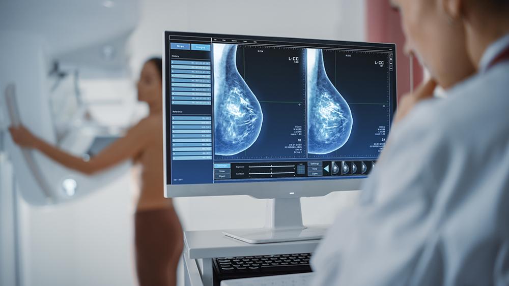 ​  New study supports annual breast cancer screening for women over 40