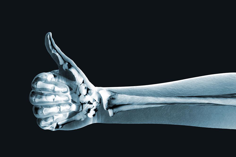 ​  Vitamins for bone health