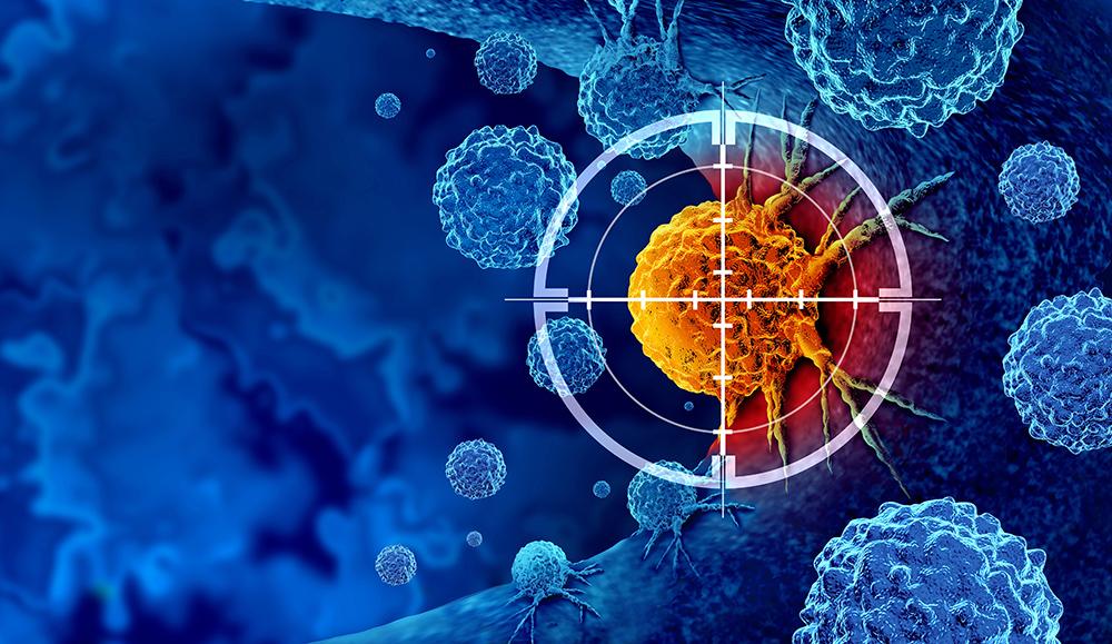 Early driver of prostate cancer aggressiveness identified