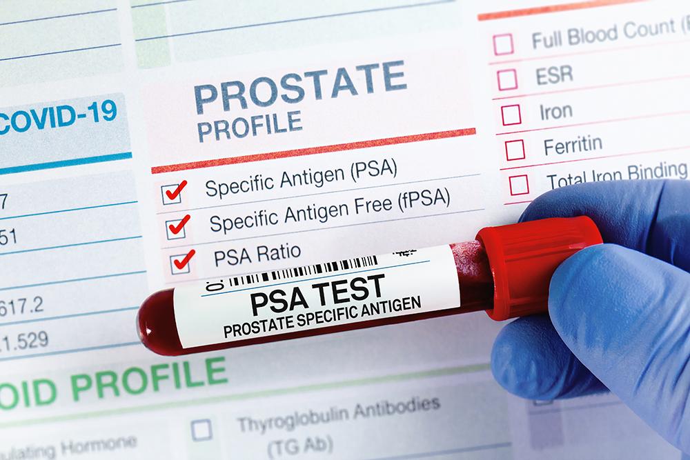 New prostate cancer blood test reaches 94 percent accuracy