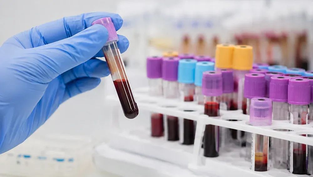 Simple blood test could detect multiple cancers, reveal where they started