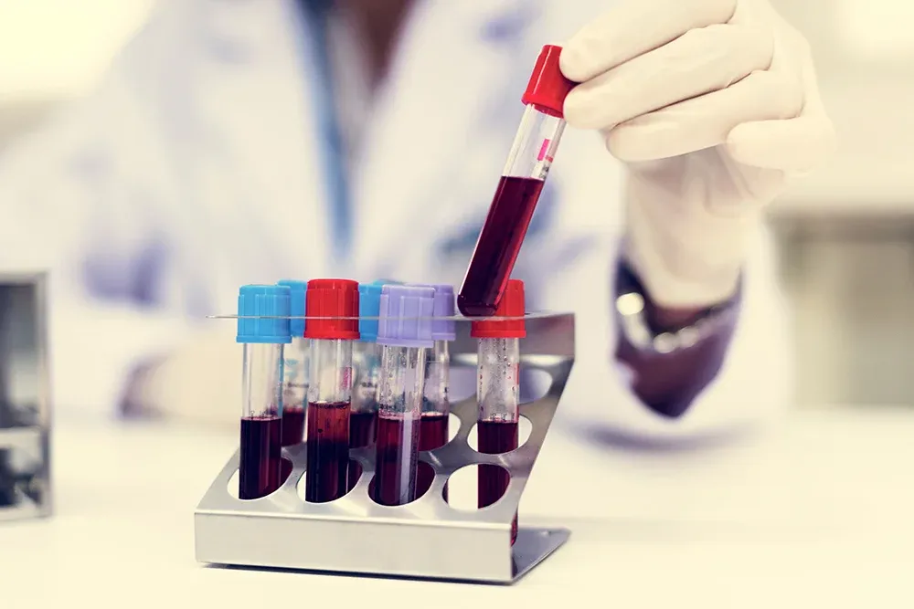 This new blood test can catch cancer 10 years early