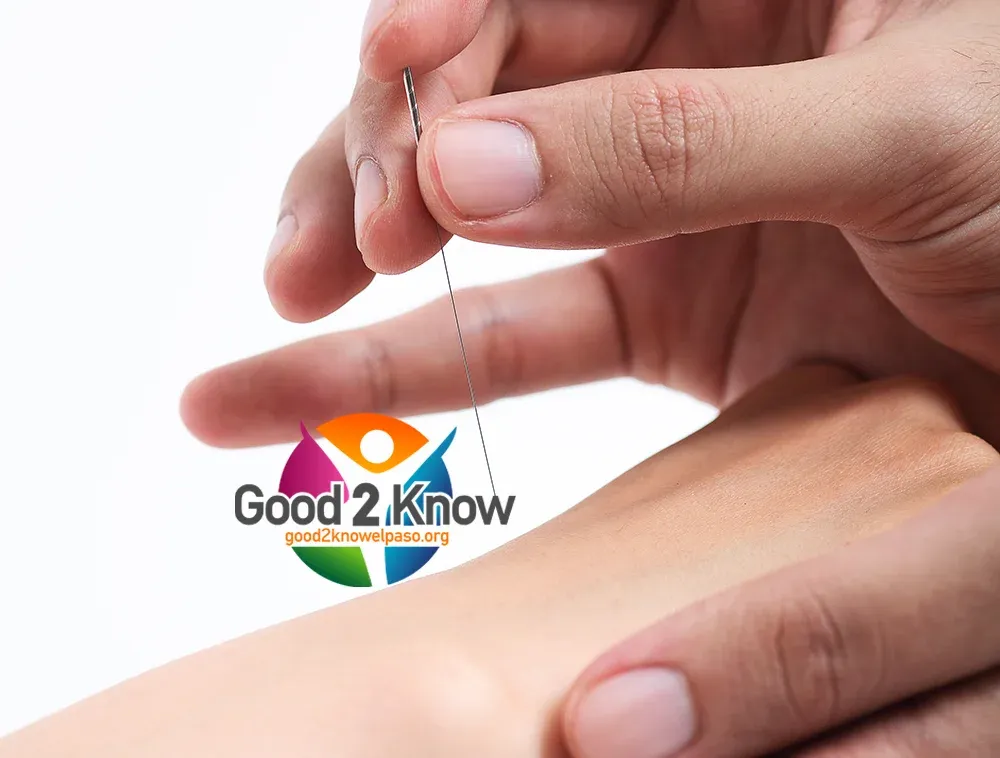 Try Acupuncture to quit smoking